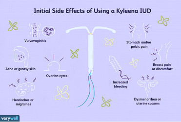 Kyleena intrauterine device - English | Domus Læknar